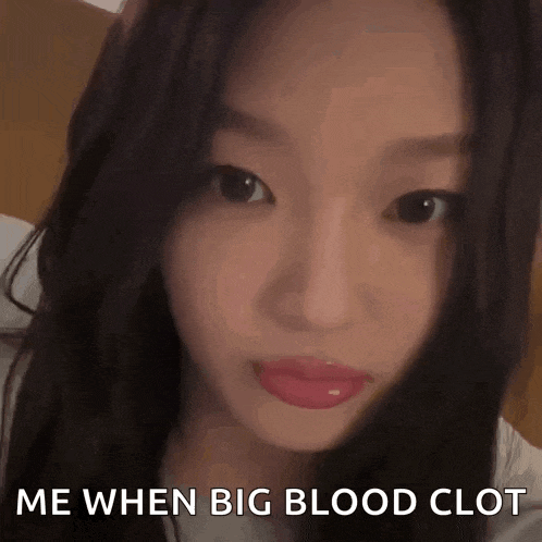 Foryoonchae Yoonchae Shocked GIF
